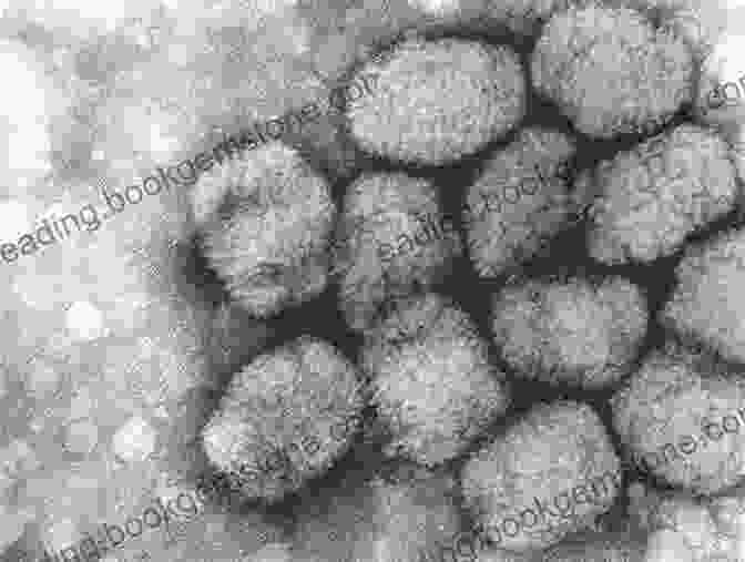 Electron Microscopy Image Of The Smallpox Virus Lost Colony Richard F Weyand